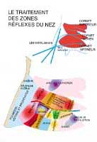 Planche plastifiée le Traitement des zones réflexes du nez (A5)